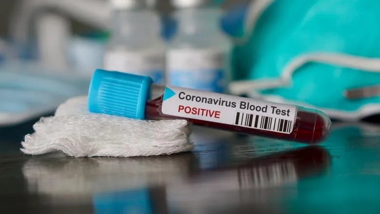 474 de cadre medicale din România, infectate cu noul COVID-19